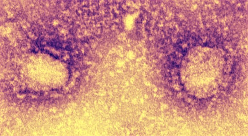 Questa immagine ha l'attributo alt vuoto; il nome del file è nuovo-coronavirus.jpg